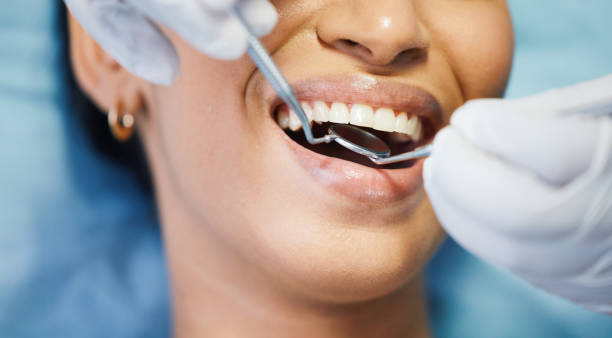 Best Emergency Broken Tooth Repair in Blue Ash, OH