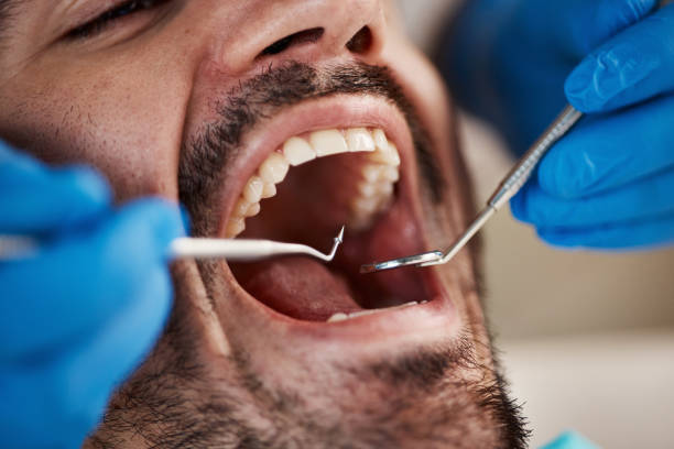 Best Pediatric Emergency Dentist in Blue Ash, OH